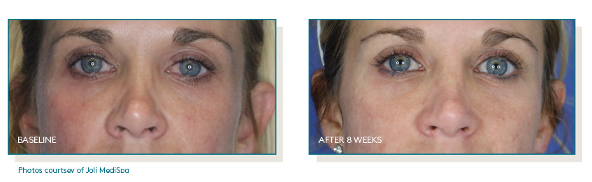 Pep Up® Collagen Boost Face & Neck Serum