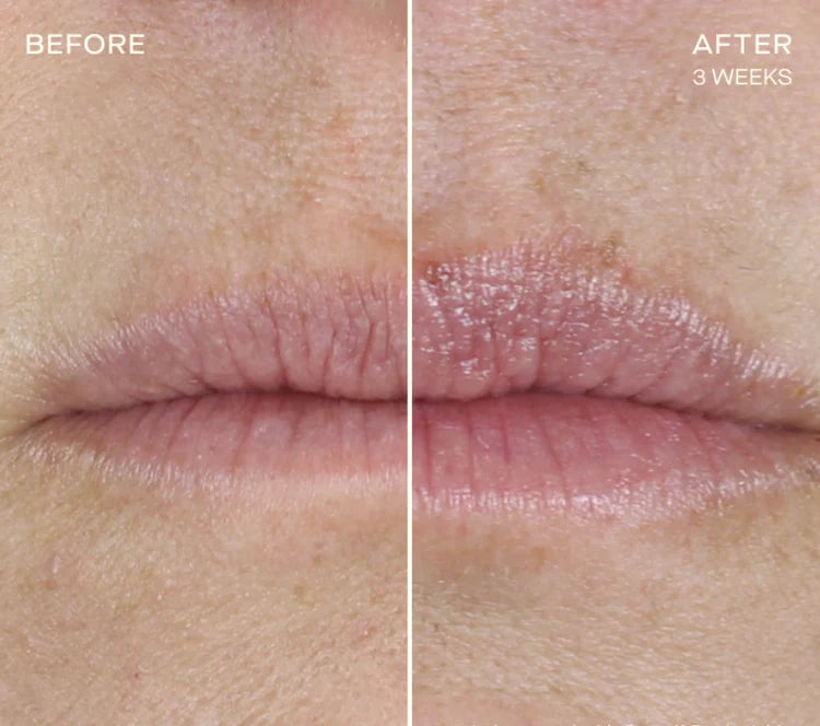 The Lip Plumping and Enhancing Regimen