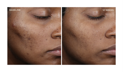 Complexion Brightening Serum