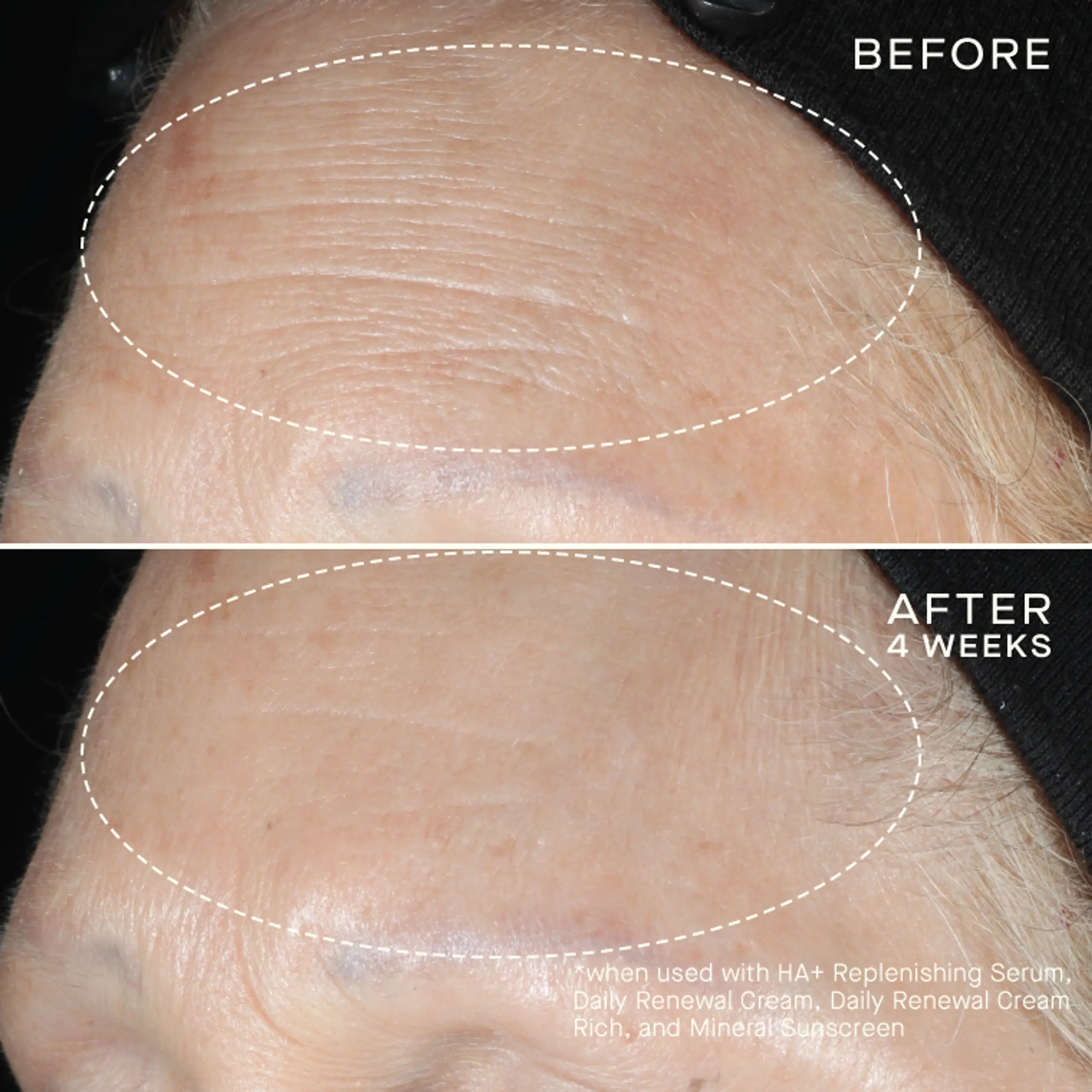 HA+ Replenishing Serum