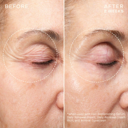 HA+ Replenishing Serum