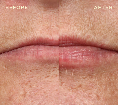 Repleneshing Lip Filler