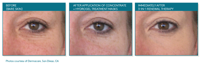 Total Eye® 3-In-1 Renewal Therapy SPF 35