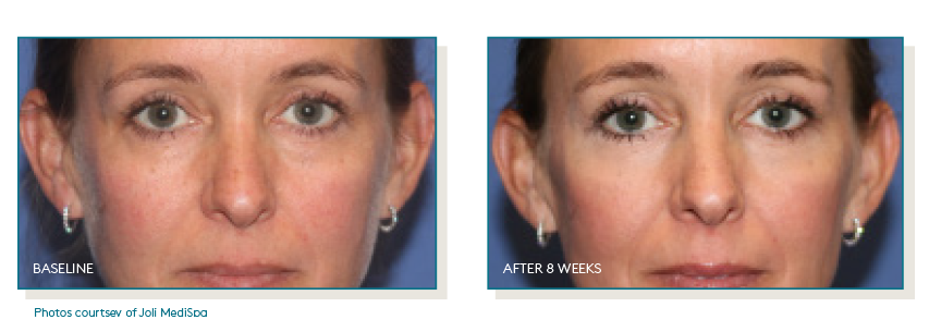 Pep Up® Collagen Boost Face & Neck Serum